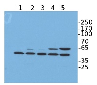 DYKDDDDK (binds to Sigma FLAGŪ, clone FG4R) in the group Tag Antibodies / DYKDDDDK (binds to SigmaFLAGŪ) at Agrisera AB (Antibodies for research) (AS15 2871)